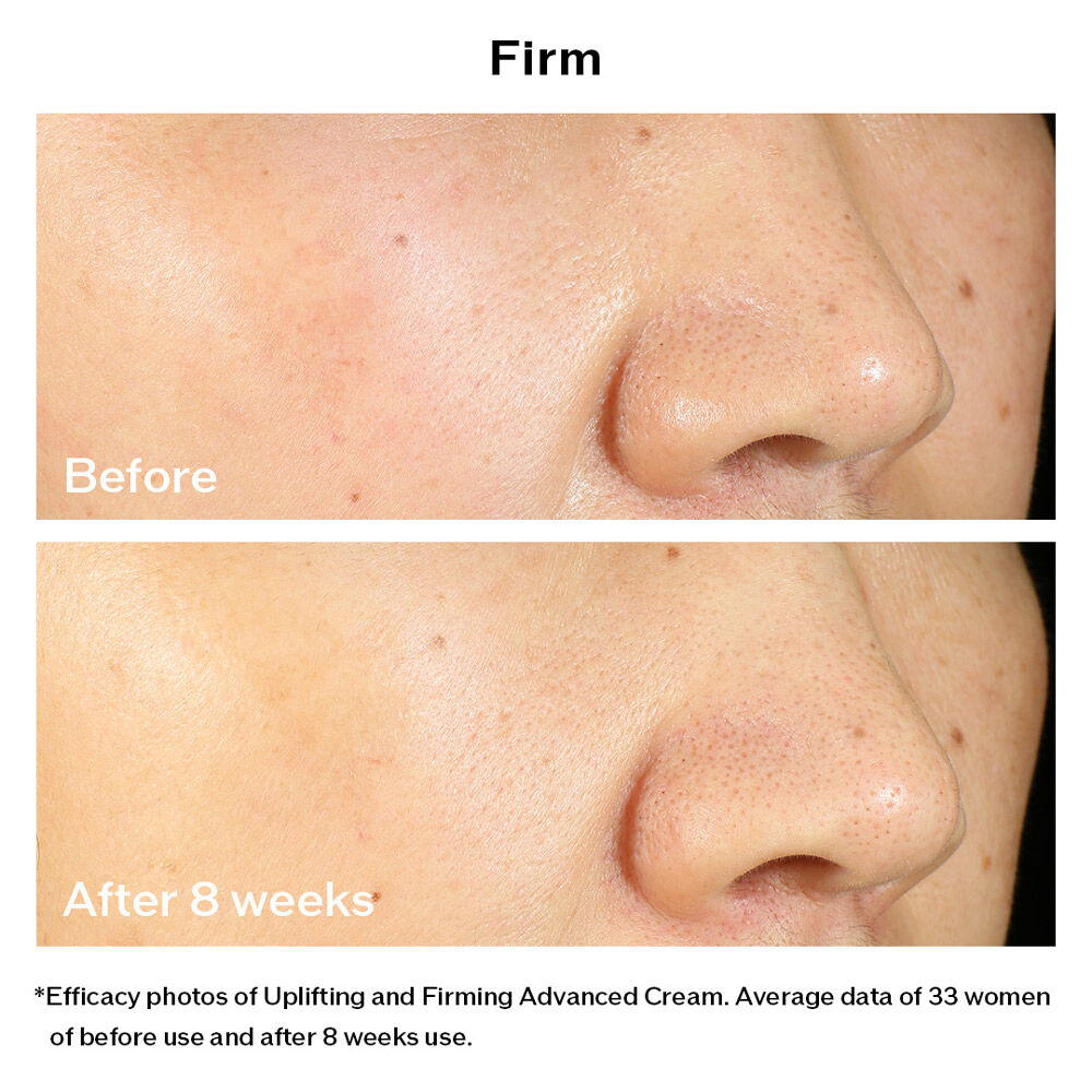 Uplifting and Firming Advanced Cream (Refill), 