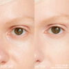 SYNCHRO SKIN RADIANT LIFTING Concealer ​, 103