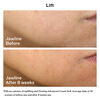 Uplifting and Firming Advanced Cream Soft  ( บรรจุภัณฑ์ Refill ), 