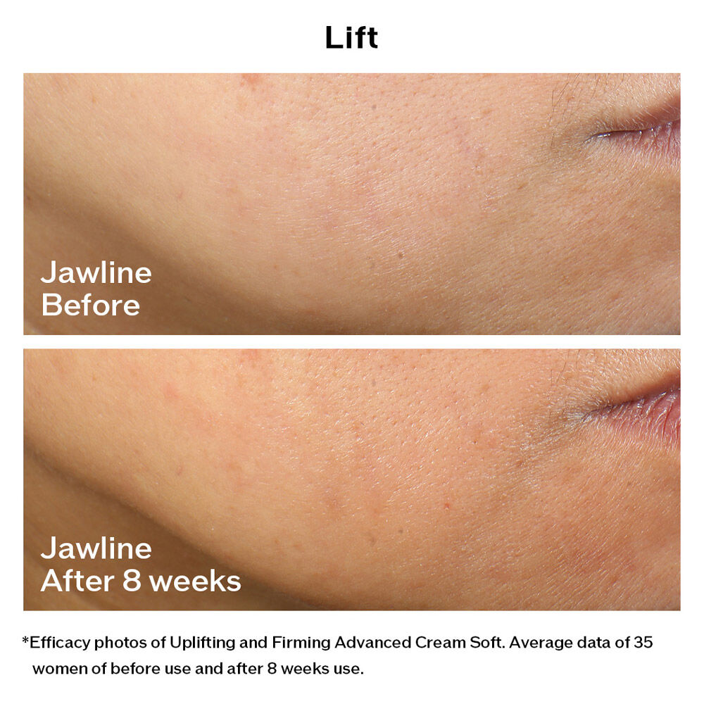 Uplifting and Firming Advanced Cream Soft  ( บรรจุภัณฑ์ Refill ), 