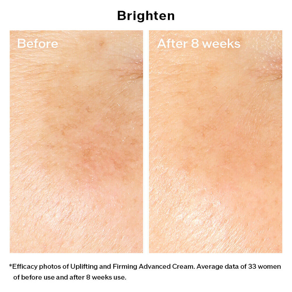 Uplifting and Firming Advanced Cream (Refill), 
