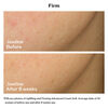 Uplifting and Firming Advanced Cream Soft  ( บรรจุภัณฑ์ Refill ), 