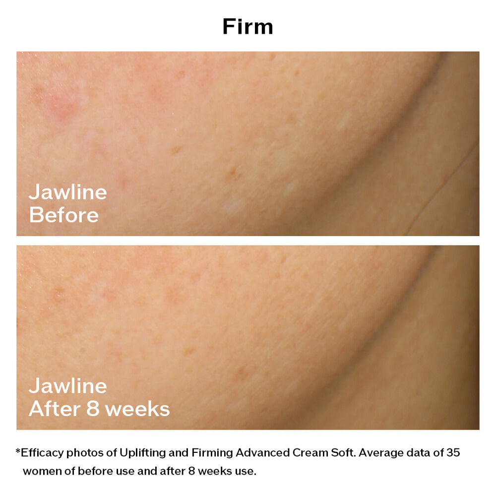 Uplifting and Firming Advanced Cream Soft  ( บรรจุภัณฑ์ Refill ), 