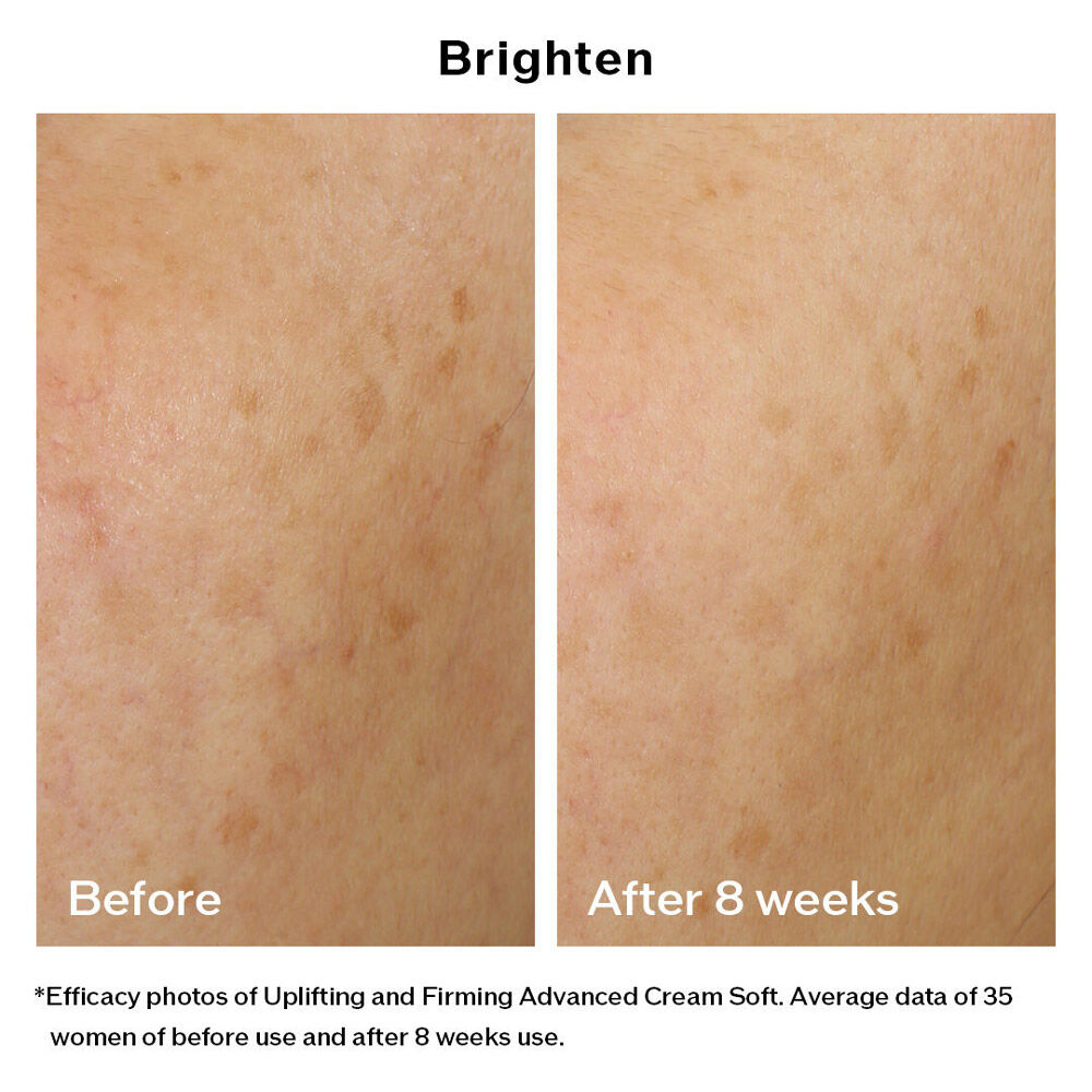 Uplifting and Firming Advanced Cream Soft, 