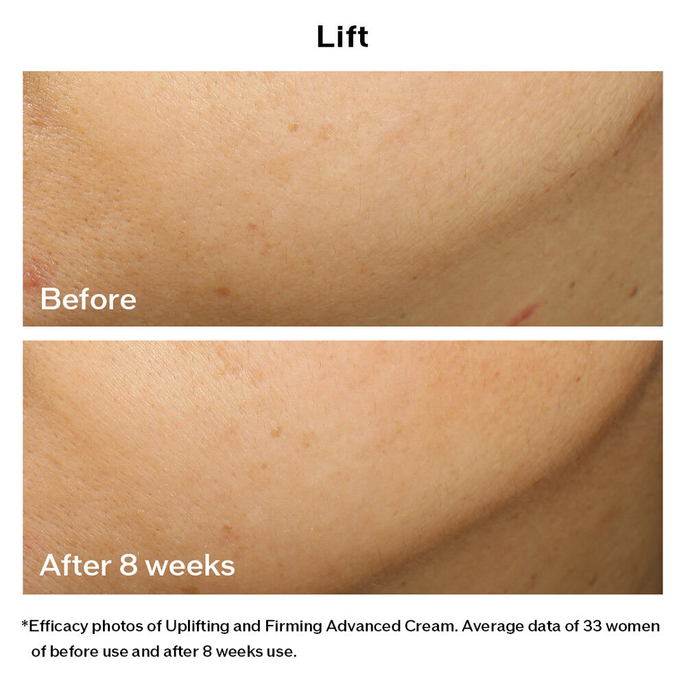 Uplifting and Firming Advanced Cream (Refill), 