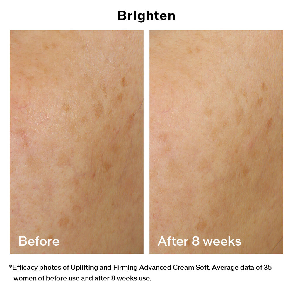 Uplifting and Firming Advanced Cream Soft  ( บรรจุภัณฑ์ Refill ), 