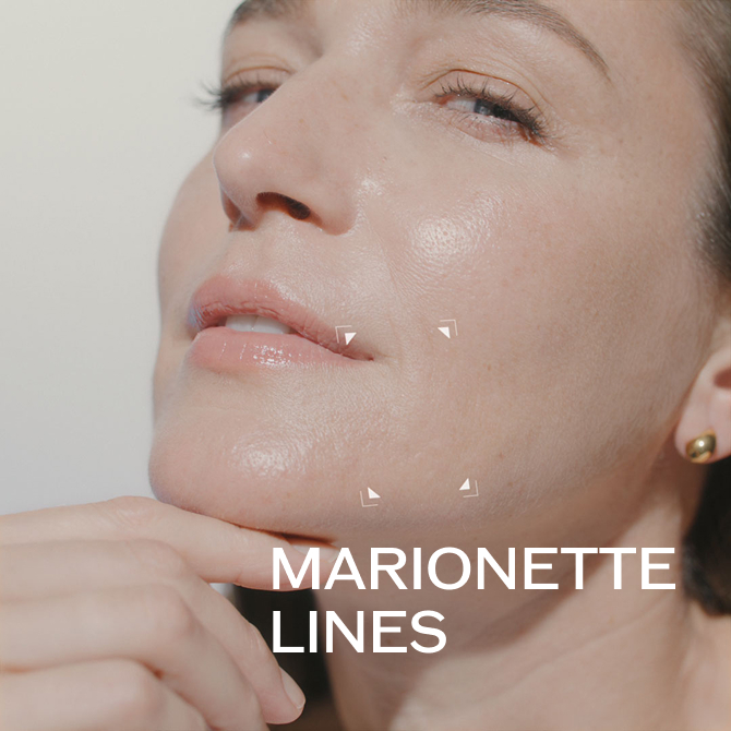 MARIONETTE LINES
